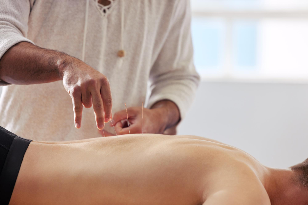 Acupressure Therapy