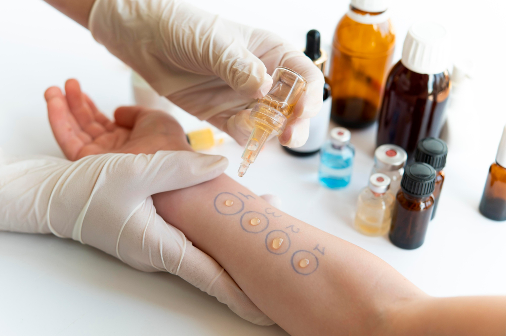 Allergy Testing