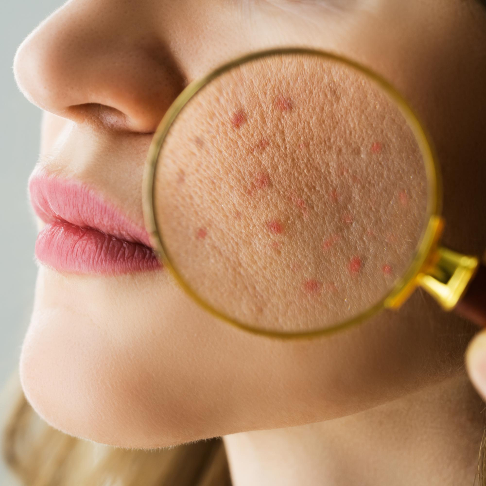 Dermatological